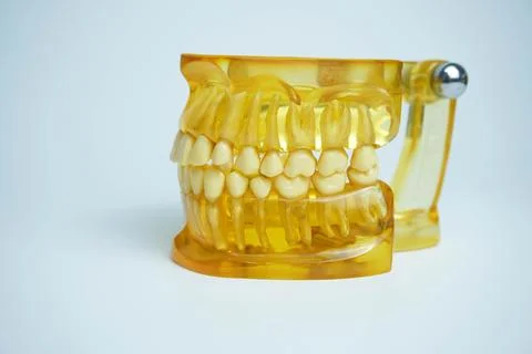 Yellow jaw model on white background. Dentures or false teeth Stock Photos