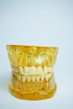 Yellow jaw model on white background. Dentures or false teeth Stock Photos