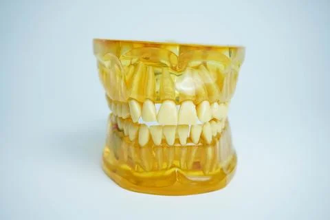 Yellow jaw model on white background. Dentures or false teeth Stock Photos