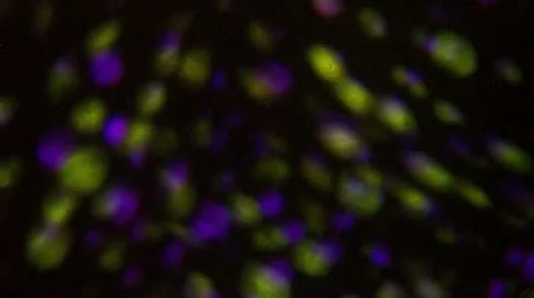 Yellow Purple Dots Video stock 11692834