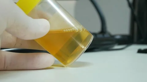 Yellow urine in bottle. Stock Footage 263535522