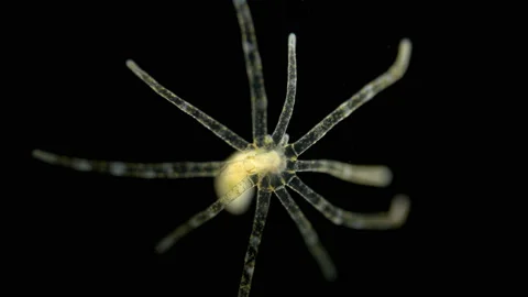Young Actiniaria under the microscope, class Anthozoa, about 5 mm in size. Stock Footage 121375538
