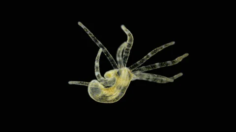 Young Actiniaria under the microscope, class Anthozoa, about 5 mm in size. Stock Footage 121376587