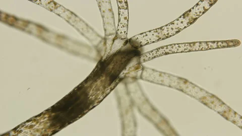 Young Actiniaria under the microscope, class Anthozoa, about 5 mm in size. Stock Footage 121378923