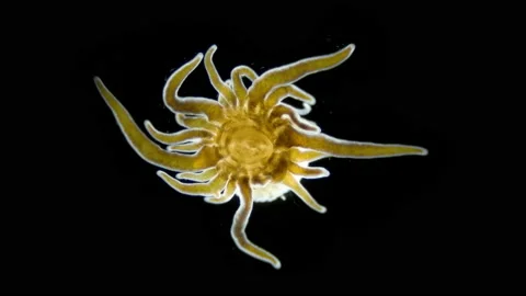Young Actiniaria under a microscope, class Anthozoa, Hexacorallia, about 5 mm in Stock Footage 235425792