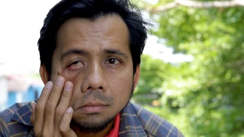 ํYoung asian man with vision problems Stock Footage 116844352