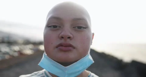 Young bald girl posing in front of camera with sunset in the background Stock Footage 161067189