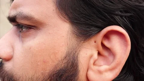 Young bearded guy with a preauricular pit near his ear. Stock Footage 162164177