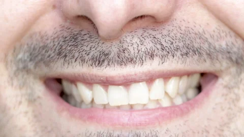 Young bearded man with small teeth is smiling to the camera Stock Footage 197058798