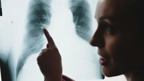 Young blonde orthopedist explaining and analyzing skull xray , close up Stock Footage 183104467