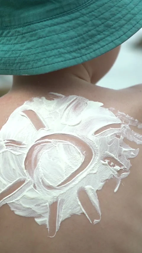 A young boy at the beach has a sun drawn with sunscreen cream on his bare back Stock Footage 347101791