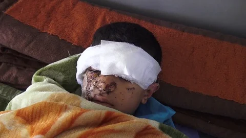 Young boy blind after terror bomb attack, Syria 2017 Stock Footage 75958685