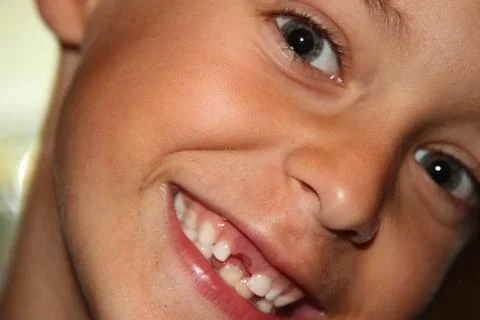 Young boy with missing teeth Foto stock
