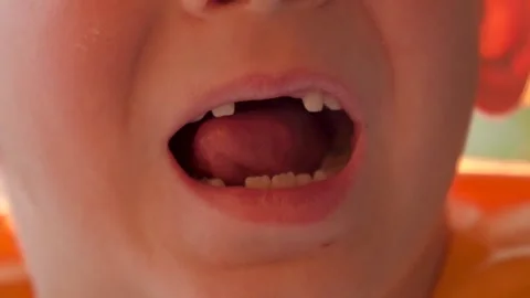 Young boy with open smile displaying missing tooth and playful demeanor Stock Footage 327087497