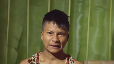 Young boy showing the upper teeth like in front of the dentist in ecuador 스톡 동영상 113180827