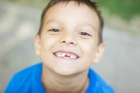 Young boy smiling and showing his changing baby teeth Foto stock