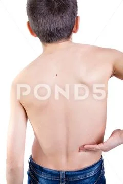 Young caucasian teenage boy who has hurt his back Stock Photos