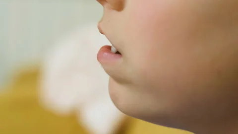Young child boy use tooth brace for dental healthcare treatment, kids family Stock Footage 220890373