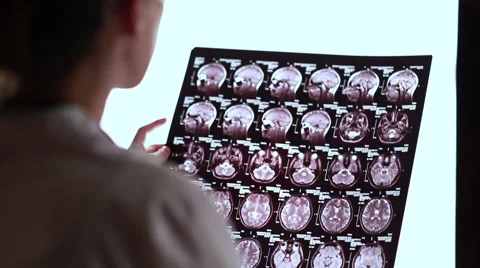 Young doctor examines tomogram closeup Stock Footage 67398098