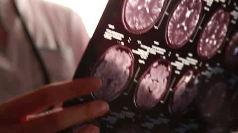 Young doctor examines tomogram closeup Видео 67398724