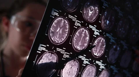 Young doctor examines tomogram Vidéo gratuite 67399333