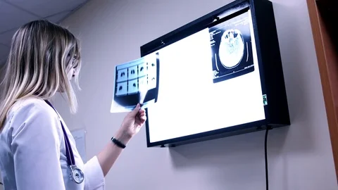 A young doctor looking at a human brain PET scans Stock Footage 72568428