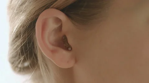 Young female pull out her hearing aid from her right ear, close up,50 fps Stock Footage 85565721