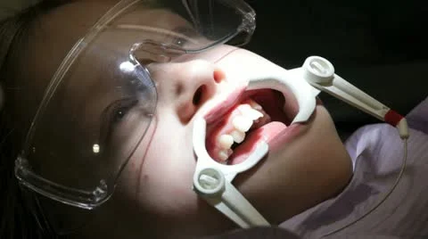 Young girl having brackets put in for braces. Stockbeeldmateriaal 10864564