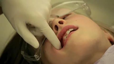 Young girl having brackets put in for braces. Vídeo Stock 10864571