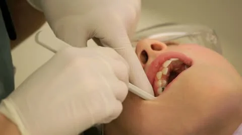 Young girl having brackets put in for braces. Stock Footage 10864573