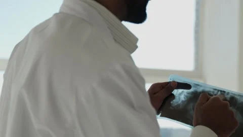 Young group of doctors looking at teeth x-ray scan image in front of window Stock Footage 292155318