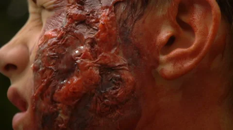 Young guy with a huge wound on his face something chews, close-up, Halloween Stock Footage 68209280