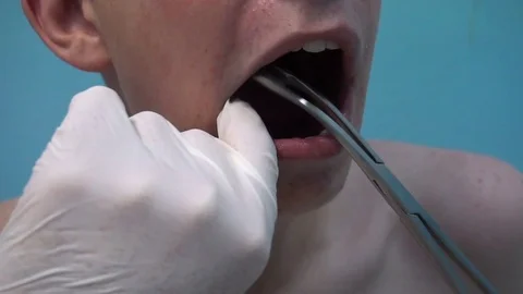 The young guy on reception at the dentist. Dental treatment 스톡 동영상 77201724