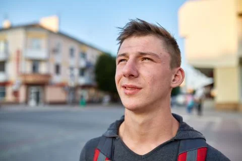 A young happy guy with problem skin having fun while walking around the summer Stock Photos