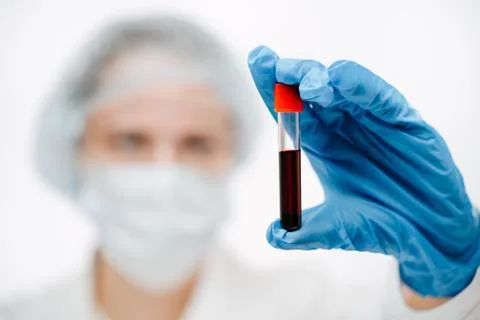 Young lab assistant in blue gloves holding blood with coronavirus in clinic 스톡 사진