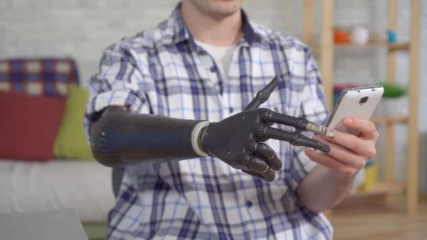 Young man adjusts a prosthetic hand with a smartphone close up Stock Footage 119568071
