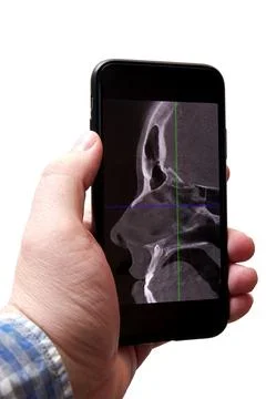 Young man analyzing an x-ray scan of his head on a phone Stock Photos