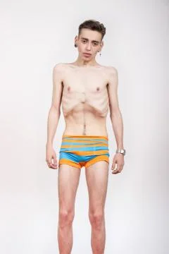 Young man with anorexia nervosa problem. Stock Photos