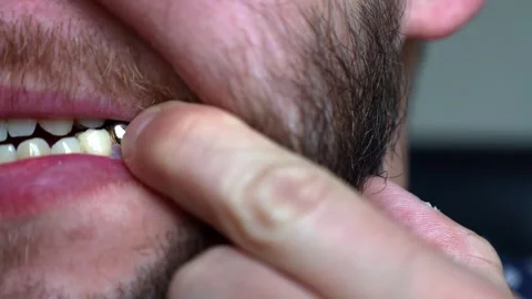 Young man with a beard examining his teeth Stock-Footage 242720194
