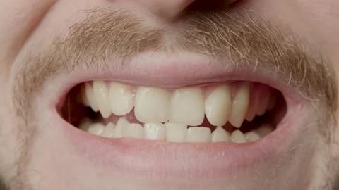 A young man with a beard smiling broadly and showing all his teeth. A young man Stock Footage 233265153