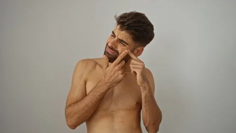 Young man with a beard squeezing a pimple on his face against a white wall .. Stock Footage 283564856