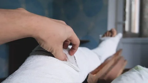 Young man with broken plaster leg Stock Footage 121667730