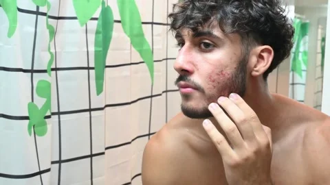Young man checking his acne in the bathroom. Vidéo 345954653