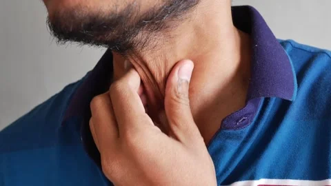 Young man checking skin elasticity on neck area showing signs of aging or d.. Vídeos de archivo 332407748