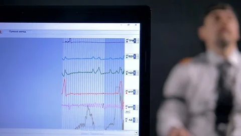 Young man connected to the lie detector circuit. Stock Footage 77125494