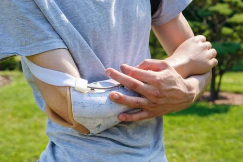 Young man with disability puts on a prosthesis outdoors Stock Photos