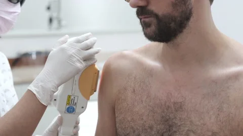 Young man getting arm and shoulder laser hair removal epilation. IPL treatment Stock-Footage 141780222