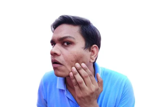 Young man having pimples checking marks on face Stock Photos