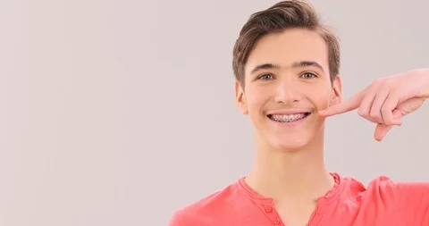 Young man points to the teeth with braces. Handsome happy teen boy with brace Stock Footage 126907775