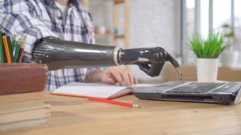 Young man with a prosthetic arm using the laptop Stock Footage 119201498